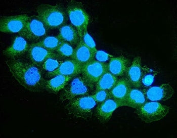 Immunofluorescent staining of FFPE human A431 cells with OXCT1 antibody (green) and DAPI nuclear sta