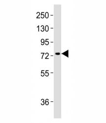 Western blot testing of MeCP2 antibody at 1:2000 dilution + mouse brain lysate; Observed molecular w
