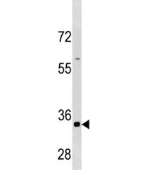 Cyclin B3 Antibody (CCNB3)