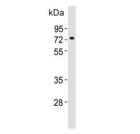 Western blot testing of mouse pancreas tissue lysate with Nr4a2 antibody. Predicted molecular weight