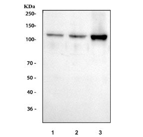 Western blot testing of human 1) HeLa, 2) COLO-320 and 3) SW620 cell lysate with Smoothelin antibody