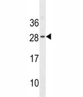 EPO antibody western blot analysis in WiDr lysate. Predicted molecular weight: 18-34 kDa depending o