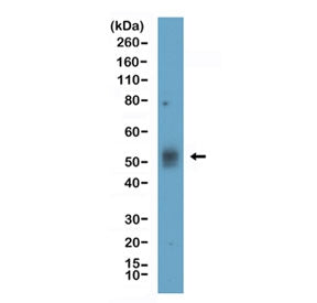 Western blot testing of human Daudi cell lysate with recombinant TIM-3 antibody at 1:1000. Expected 