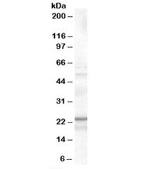 TIRAP Antibody