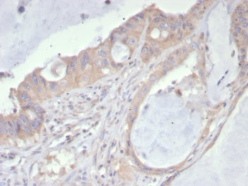 PDGFRA Antibody / Platelet Derived Growth Factor Receptor alpha