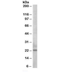 Western blot testing of K562 lysate with Bim antibody at 0.5ug/ml. Predicted molecular weight: 12-22