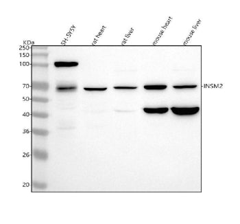Western blot analysis of INSM2 using anti-INSM2 antibody. Lane 1: human SH-SY5Y whole cell lysates, 