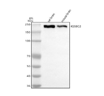 Western blot analysis of IQSEC2 using anti-IQSEC2 antibody. Electrophoresis was performed on a 8% SD