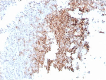 IHC staining of FFPE human spleen with recombinant CD21 antibody (clone rCR2/1952). HIER: boil tissu