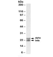 Western blot testing of human spleen lysate with Caveolin 1 antibody at 0.01ug/ml. Alpha and beta CA