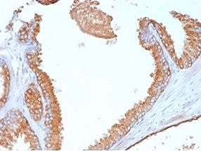 IHC staining of FFPE human prostate tissue with Glypican-3 antibody (clone GPC3/7107). HIER: boil ti