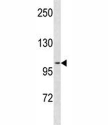 PR antibody western blot analysis in ZR-75-1 lysate. Expected molecular weight: 82-94 kDa (isoform A