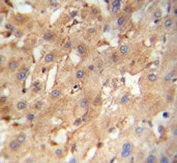 NEU4 antibody immunohistochemistry analysis in formalin fixed and paraffin embedded human hepatocarc