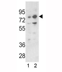 Western blot analysis of PLZF antibody and 1) 293 and 2) K562 lysate. Predicted molecular weight: 74