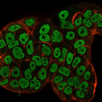 Immunofluorescence staining of human MCF-7 cells with Estrogen Receptor alpha antibody (green, clone