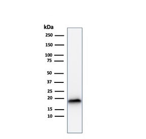 Western blot testing of human COLO-38 cell lysate with recombinant Melan-A antibody (clone rMLANA/78