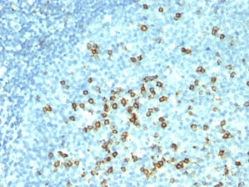 CD57 / HNK-1 Antibody Cocktail