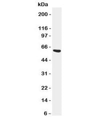 Western blot testing of SERPINA3 antibody and SMMC-7721 cell lysate. Predicted molecular weight: 47/