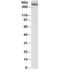 Western blot testing of human peripheral blood lymphocyte lysate with MYH9 antibody at 0.3ug/ml. Pre