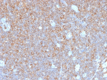 IHC staining of FFPE human tonsil tissue with recombinant PARVG antibody (clone PARVG/6312R). HIER: boil tissue sections in pH 9 10mM Tris with 1mM EDTA for 20 min and allow to cool before testing.