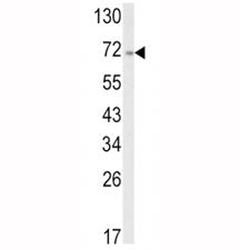 ATF6 Antibody