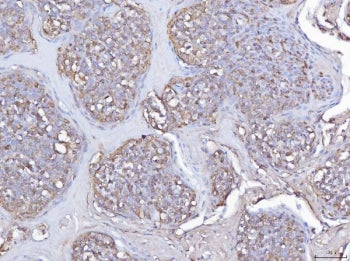 Pleckstrin Antibody / PLEK