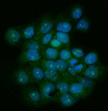 Immunofluorescent staining of FFPE human A431 cells with Telomeric repeat-binding factor 1 antibody 