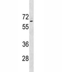p63 Antibody