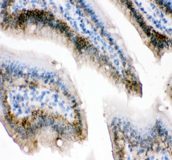 Immunohistochemical staining of E-Cadherin/Cdh1 using anti-Cdh1 antibody. E-Cadherin/Cdh1 was detect