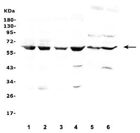 LBP Antibody / Lipopolysaccharide Binding Protein