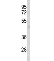 ACR Antibody / Acrosin