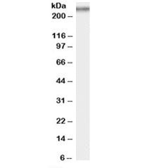Western blot testing of rat testis lysate with COL7A1 antibody at 0.5ug/ml. Expected molecular weigh