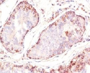 MAGE-1 Antibody