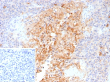 Alpha 1 Antitrypsin Antibody / AAT / SERPINA1