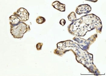 FGF3 Antibody / Fibroblast growth factor 3