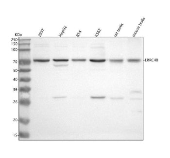 Western blot analysis of LRRC40 using anti-LRRC40 antibody. Lane 1: human 293T whole cell lysates, L