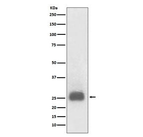 Western blot testing of lysate from TPA-treated human HL60 cells with TIMP1 antibody. Expected molec