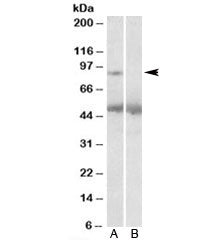 Western blot testing of human placenta lysate with USP6 antibody at 2ug/ml with [B] and without [A] 