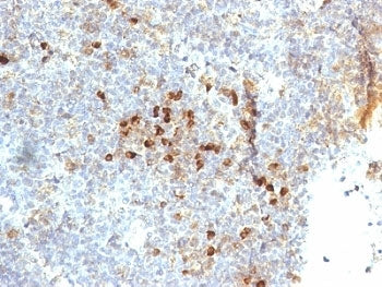 IHC: Formalin-fixed, paraffin-embedded human tonsil stained with HLA-DR antibody (clone 19-26.1 or M