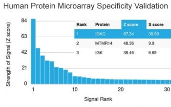 Analysis of HuProt(TM) microarray containing more than 19,000 full-length human proteins using anti-