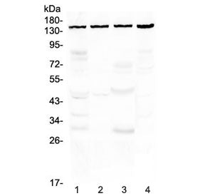 Western blot testing of human 1) HeLa, 2) COLO320, 3) MCF7 and 4) 293T cell lysate with TRPC4 antibo