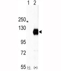 Western blot analysis of EphA2 antibody and 293 cell lysate (2 ug/lane) either nontransfected (Lane 