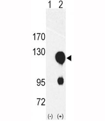 Western blot analysis of ROR2 antibody and 293 cell lysate either nontransfected (Lane 1) or transie