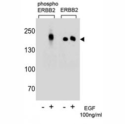 Western blot analysis of extracts from A431 cells, untreated or treated with EGF (100ng/ml) using p-