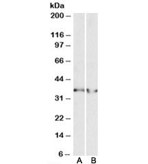 Western blot testing of human heart [A] and human kidney [B] lysates with LDHB antibody at 0.3ug/ml.