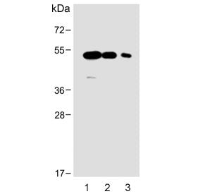Western blot testing of human 1) brain, 2) breast and 3) placenta lysate with ENT1 antibody. Predict