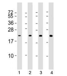 RAB13 Antibody