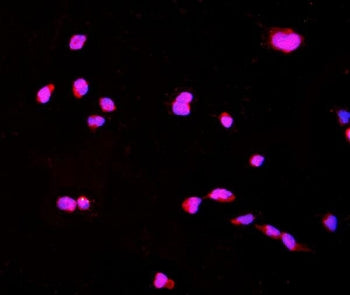 Immunofluorescent staining of FFPE mouse HEPA1-6 cells with CTHRC1 antibody (red) and DAPI nuclear stain (blue). HIER: steam section in pH6 citrate buffer for 20 min.