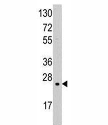 SOD2 Antibody