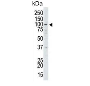 Western blot testing of human HeLa cell lysate with USP13 antibody. Predicted molecular weight ~97 k